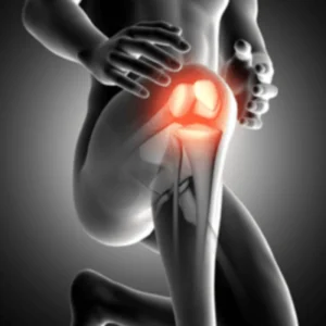 TRATAMENTO E PREVENÇÃO DA OSTEOARTRITE​